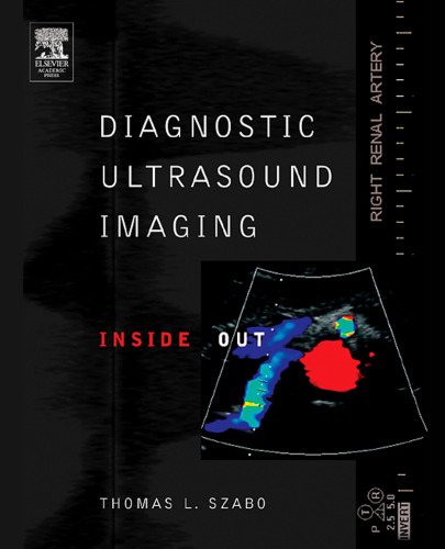 Diagnostic ultrasound imaging : inside out