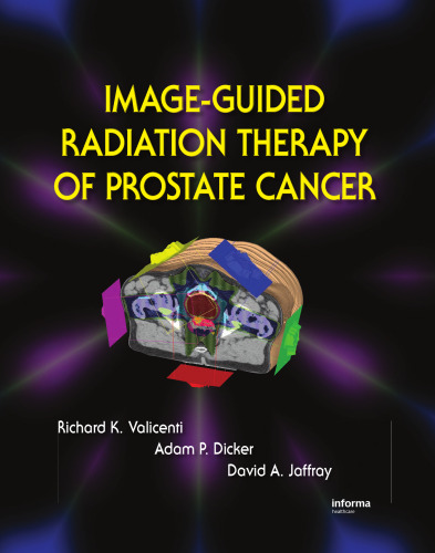 Image-Guided Radiation Therapy of Prostate Cancer