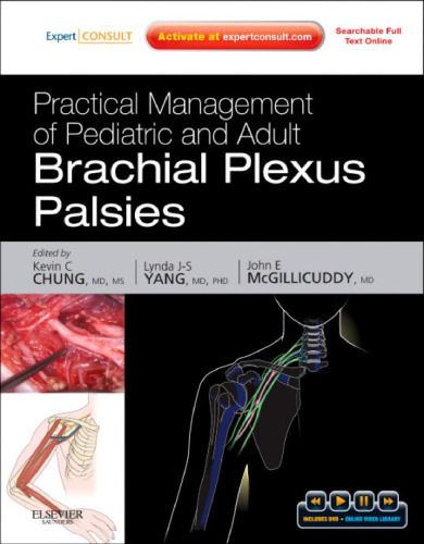 Practical Management of Pediatric and Adult Brachial Plexus Palsies: Expert Consult