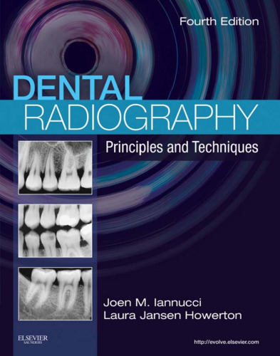 Dental Radiography: Principles and Techniques, 4e