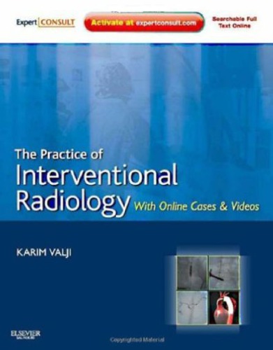 The Practice of Interventional Radiology