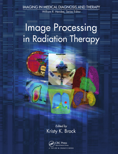 Image Processing in Radiation Therapy