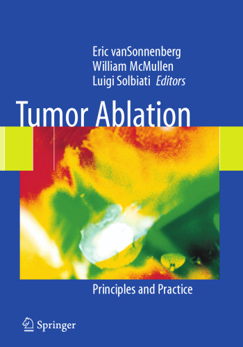 Tumor Ablation: Principles and Practice