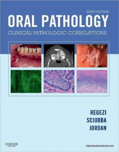 Oral Pathology: Clinical Pathologic Correlations, 6th Edition