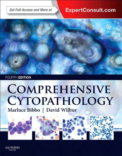 Comprehensive Cytopathology: Expert Consult: Online and Print