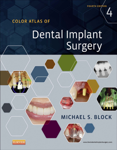 Color Atlas of Dental Implant Surgery, 4e