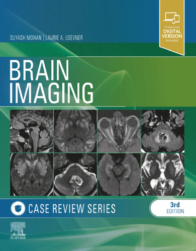 Brain Imaging: Case Review Series 3rd Edition