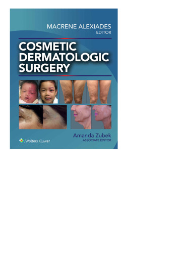 Cosmetic Dermatologic Surgery