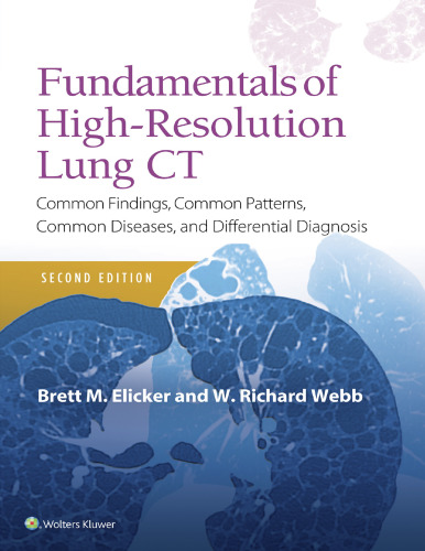 Fundamentals of High-Resolution Lung CT: Common Findings, Common Patterns, Common Diseases and Differential Diagnosis