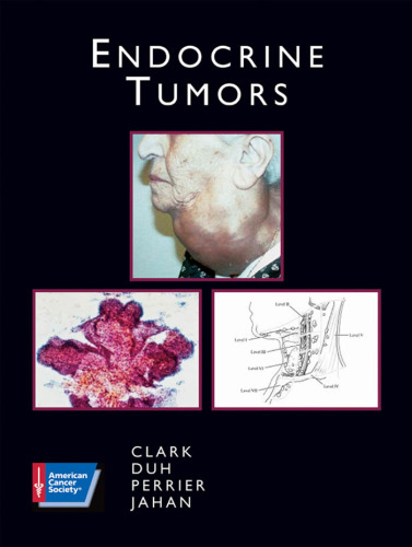 Endocrine Tumors (Atlas of Clinical Oncology)