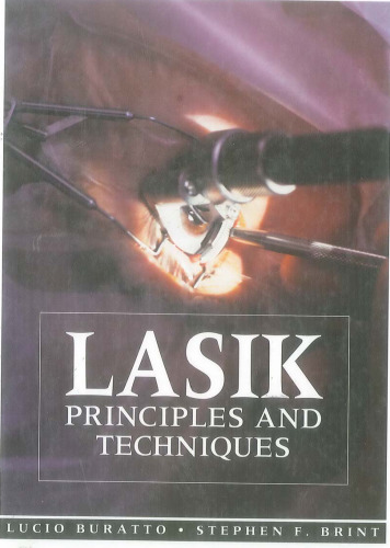 LASIK: Principles and Techniques