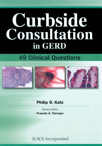 Curbside Consultation in GERD: 49 Clinical Questions