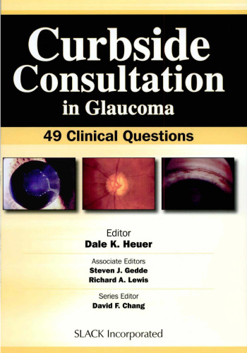 Curbside Consultation in Glaucoma: 49 Clinical Questions
