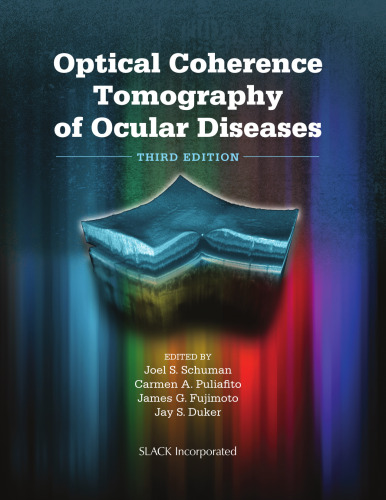Optical Coherence Tomography of Ocular Diseases