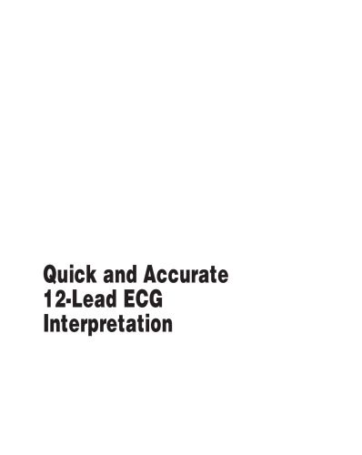 Quick and accurate 12-lead ECG interpretation