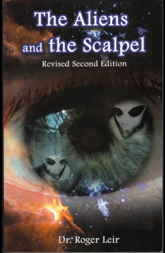 The aliens and the scalpel. Scientific proof of extraterrestrial implants in humans