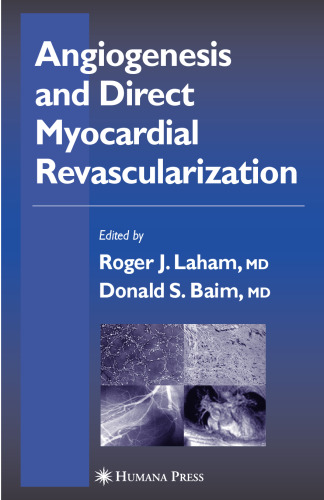 Angiogenesis and Direct Myocardial Revascularization (Contemporary Cardiology)