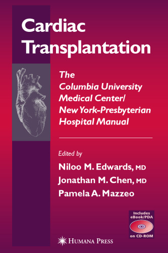 Cardiac Transplantation (Contemporary Cardiology)