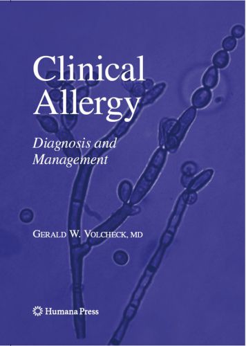 Clinical Allergy: Diagnosis and Management
