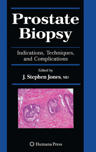 Prostate Biopsy: Indications, Techniques, and Complications
