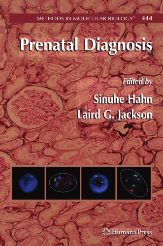 Prenatal Diagnosis (Methods in Molecular Biology, 444)