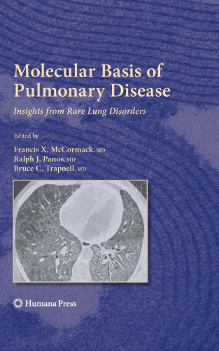 Molecular Basis of Pulmonary Disease: Insights from Rare Lung Disorders