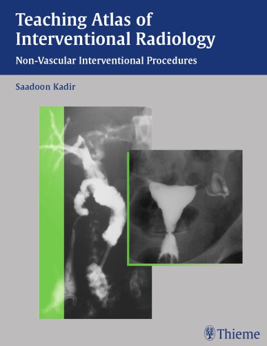 Teaching atlas of interventional radiology: Non-vascular interventional procedures