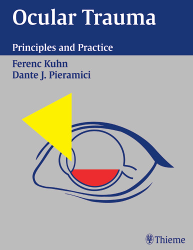 Ocular trauma : principles and practice