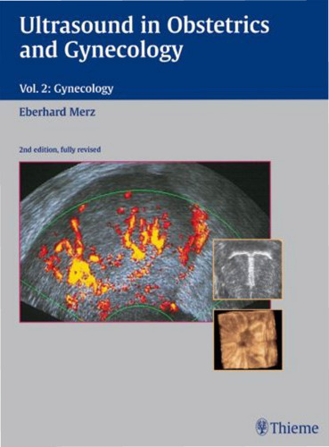 Ultrasound in Obstetrics And Gynecology: Textbook and Atlas, Volume 2 - Gynecology