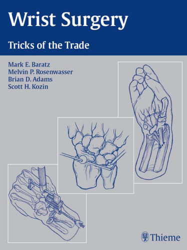 Wrist surgery: tricks of the trade