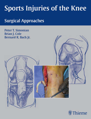 Sports Injuries of the Knee: Surgical Approaches