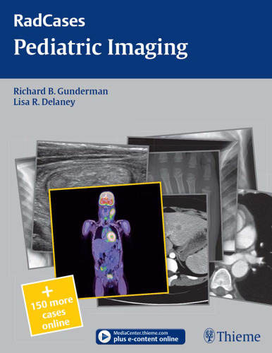 Pediatric Imaging