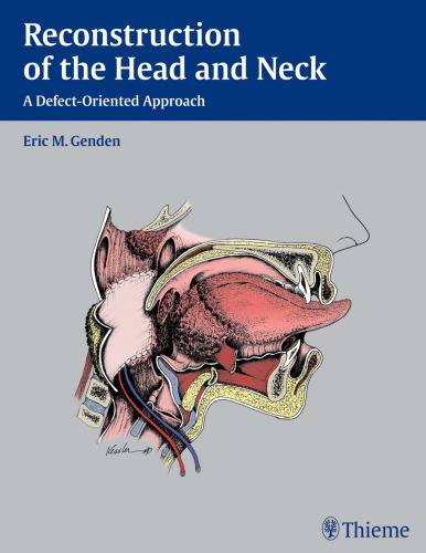 Reconstruction of the Head and Neck: A Defect-Oriented Approach