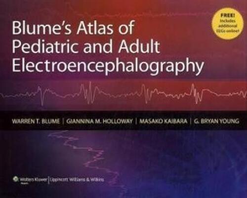 Blume's Atlas of Pediatric and Adult Electroencephalography