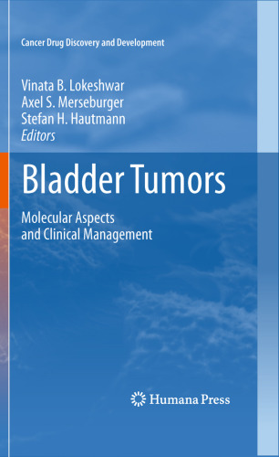 Bladder Tumors:: Molecular Aspects and Clinical Management
