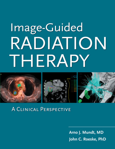 Image Guided Radiation Therapy