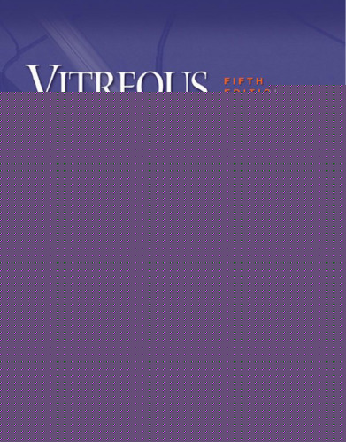 Vitreous Microsurgery