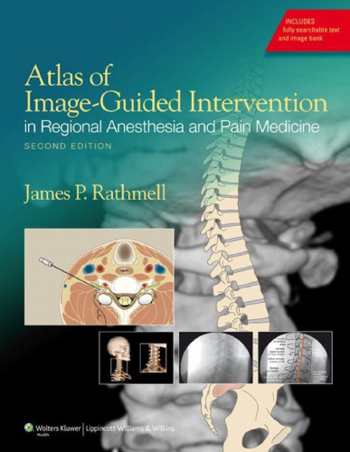 Atlas of Image-Guided Intervention in Regional Anesthesia and Pain Medicine