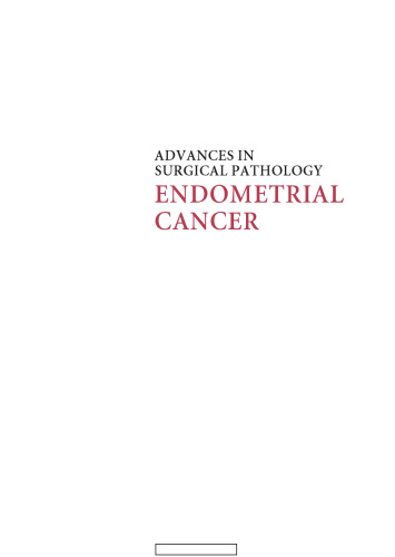 Advances in Surgical Pathology: Endometrial Carcinoma