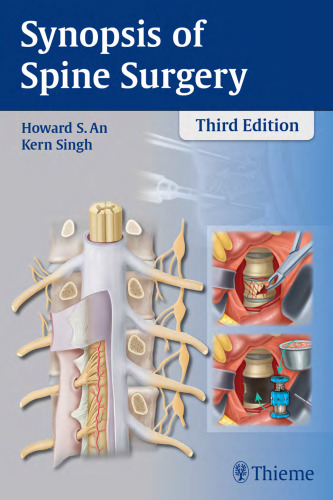 Synopsis of Spine Surgery, 3E