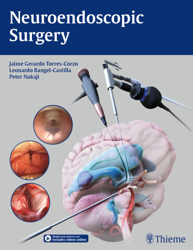 Neuroendoscopic Surgery
