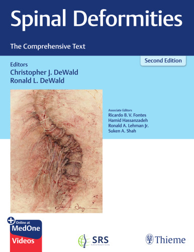 Spinal Deformities: The Comprehensive Text