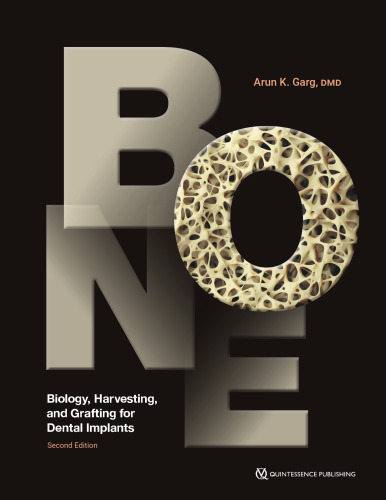 Bone: Biology, Harvesting, and Grafting for Dental Implants