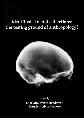 Identified skeletal collections: the testing ground of anthropology?