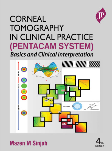 Corneal Tomography in Clinical Practice (Pentacam System)
