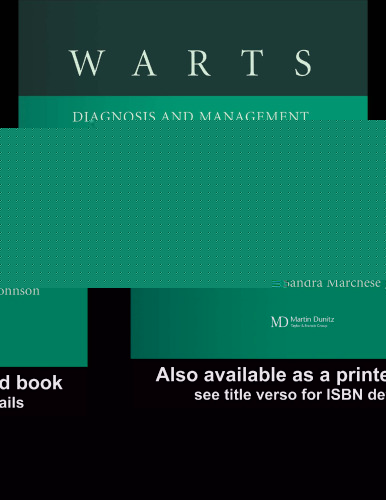 Warts: Diagnosis and Management: An Evidence Based Approach