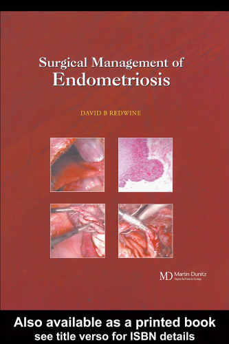 Surgical Management of Endometriosis