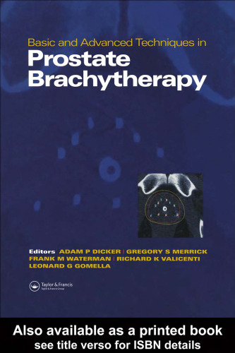 Basic and Advanced Techniques in Prostate Brachytherapy