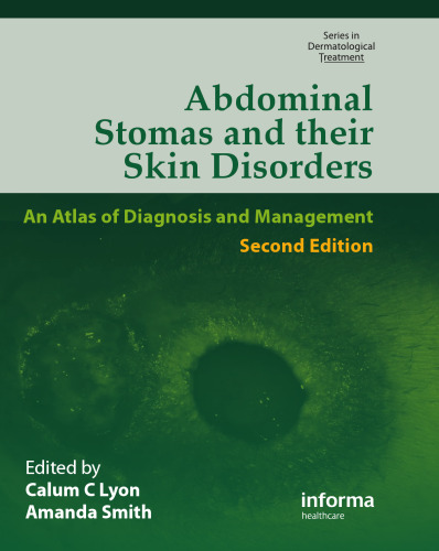 Abdominal Stomas and Their Skin Disorders, Second Edition (Series in Dermatological Treatment)