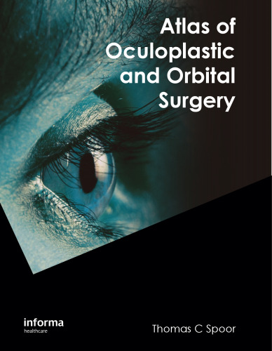 Atlas of Oculoplastic and Orbital Surgery